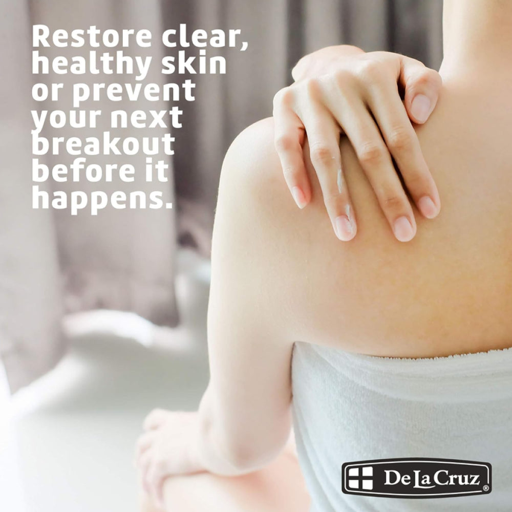 De La Cruz 10% Sulfur Acne Treatment Ointment